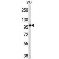 Dipeptidyl Peptidase 8 (DPP8) Antibody