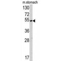 Suppressor of Variegation 4-20 Homolog 2 (SUV4-20H2) Antibody