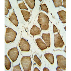 Caveolin 3 (CAV3) Antibody