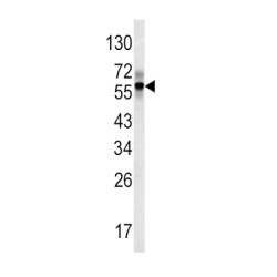 Fibrinogen Beta (FGB) Antibody