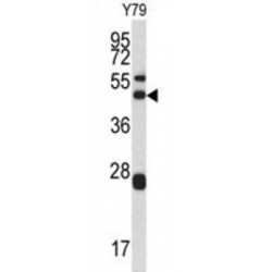 Actin-Related Protein 2/3 Complex Subunit 1A (ARPC1A) Antibody