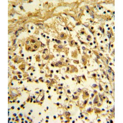 Alpha-Enolase (ENO1) Antibody