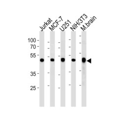 Alpha-Enolase (ENO1) Antibody