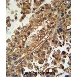 ATP Binding Cassette Subfamily G Member 1 (ABCG1) Antibody