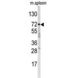 ATP Binding Cassette Subfamily G Member 1 (ABCG1) Antibody