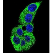 Actin Gamma 1 (ACTG1) Antibody