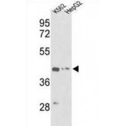 Actin Gamma 1 (ACTG1) Antibody
