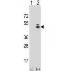 Actin Gamma 1 (ACTG1) Antibody