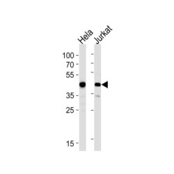 Actin-Related Protein 2 (ACTR2) Antibody