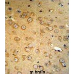 Von Hippel-Lindau Disease Tumor Suppressor (VHL) Antibody