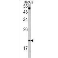 Von Hippel-Lindau Disease Tumor Suppressor (VHL) Antibody