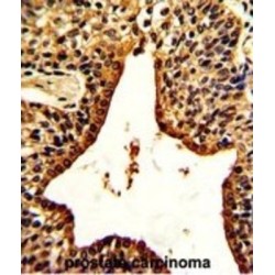 Vasoactive Intestinal Peptide (VIP) Antibody