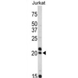 Vasoactive Intestinal Peptide (VIP) Antibody