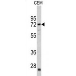 Carnitine O-Acetyltransferase (CRAT) Antibody
