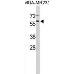 Cathepsin F (CTSF) Antibody