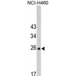 FK506 Binding Protein 14 (FKBP14) Antibody