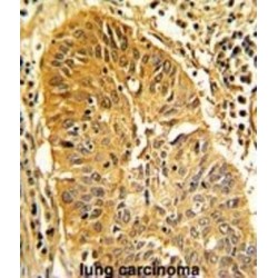 Caldesmon (CALD1) Antibody
