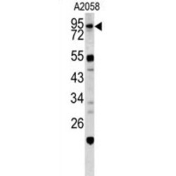 Caldesmon (CALD1) Antibody