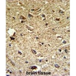 Carbon Catabolite Repression 4 Like Protein (CCRN4L) Antibody