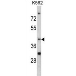 Carbon Catabolite Repression 4 Like Protein (CCRN4L) Antibody