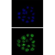 Transforming Growth Factor-Beta-Inducible Early Growth Response Protein 2 (TIEG2) Antibody