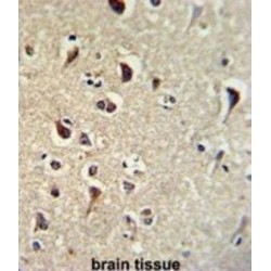 Transforming Growth Factor-Beta-Inducible Early Growth Response Protein 2 (TIEG2) Antibody