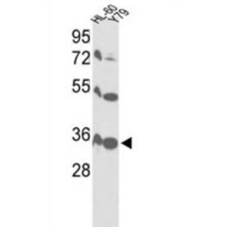 Voltage-Dependent Anion-Selective Channel Protein 1 (VDAC1) Antibody