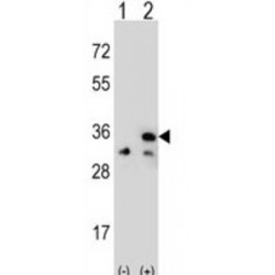 Voltage-Dependent Anion-Selective Channel Protein 1 (VDAC1) Antibody