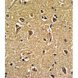 Voltage-Dependent Calcium Channel Gamma-5 Subunit (CACNG5) Antibody