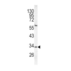 Voltage-Dependent Calcium Channel Gamma-5 Subunit (CACNG5) Antibody