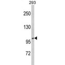 CTD Phosphatase Subunit 1 (CTDP1) Antibody