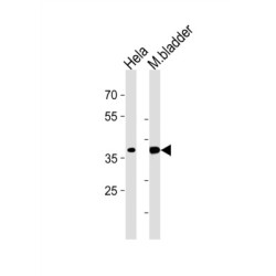 Eukaryotic Translation Initiation Factor 3 Subunit H (EIF3H) Antibody