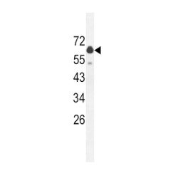 Glutaminase Liver Isoform, Mitochondrial (GLS2) Antibody