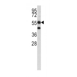Hydroxymethylglutaryl-CoA Synthase, Cytoplasmic (HMGCS1) Antibody