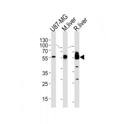 Hydroxymethylglutaryl-CoA Synthase, Cytoplasmic (HMGCS1) Antibody