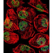 TATA Box Binding Protein (TBP) Antibody