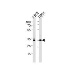 TATA Box Binding Protein (TBP) Antibody