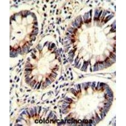 Thymidylate Synthase (TYMS) Antibody