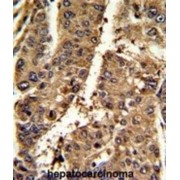 Proteasome Activator Complex Subunit 2 (PSME2) Antibody