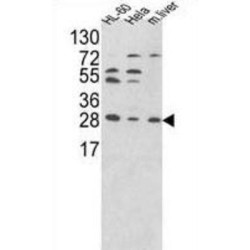 Proteasome Activator Complex Subunit 2 (PSME2) Antibody