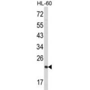 GTP-Binding Nuclear Protein RAN (RAN) Antibody
