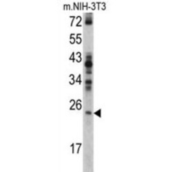 GTP-Binding Nuclear Protein RAN (RAN) Antibody