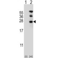GTP-Binding Nuclear Protein RAN (RAN) Antibody