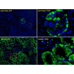 Transthyretin (TTR) Antibody