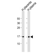 WB analysis of (1) Human placenta lysate and (2) Human plasma lysate (20 µg/lane) using TTR antibody, followed by a Goat anti-Rabbit IgG H&L antibody conjugated to HRP (1/10000 dilution). Calculated MW: 16 kDa.
