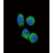 C-C Motif Chemokine 2 / MCP1 (CCL2) Antibody
