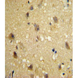 C-C Motif Chemokine 2 / MCP1 (CCL2) Antibody