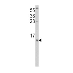 C-C Motif Chemokine 2 / MCP1 (CCL2) Antibody