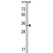 Myeloid Leukemia Factor 1 (MLF1) Antibody