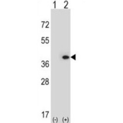 Myeloid Leukemia Factor 1 (MLF1) Antibody
